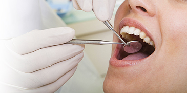 dental cleaning in North York